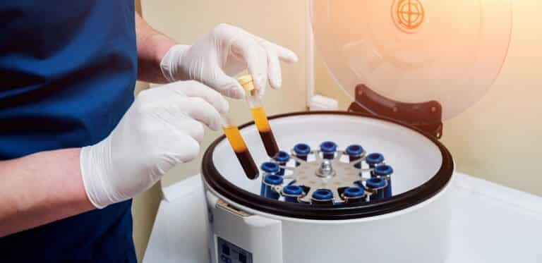 PRP Treatment in Amman, Jordan
